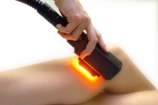 Laserontharing Dames onderbenen en knie